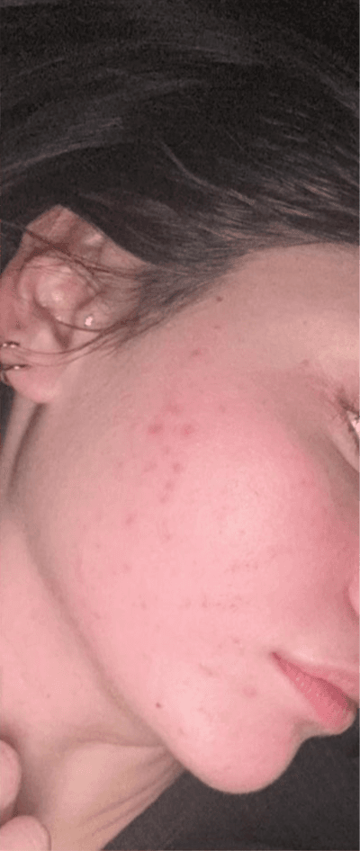 The client's successful results after treatment.